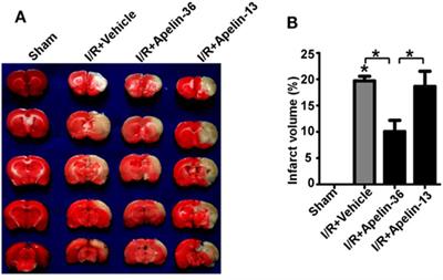 Low Dose of Apelin-36 Attenuates ER Stress-Associated Apoptosis in Rats with Ischemic Stroke